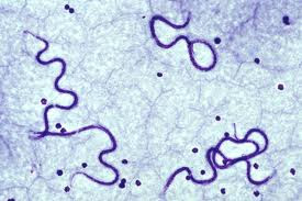 Larvas na corrente sanguínea de animal infectado. (Foto: Reprodução / CachorrosBlogs)